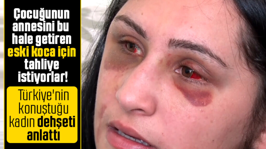 Samsun'da öldüresiye darp edilen kadın evinde açıklamalarda bulundu