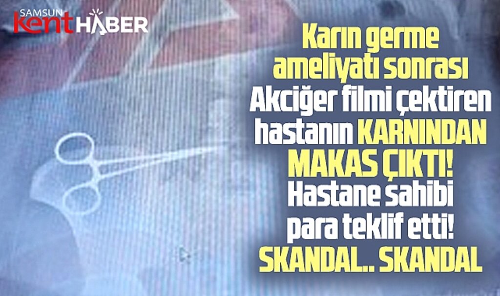 Samsun'da estetik kliniğinde skandal! Hastanın karnında makas unutuldu